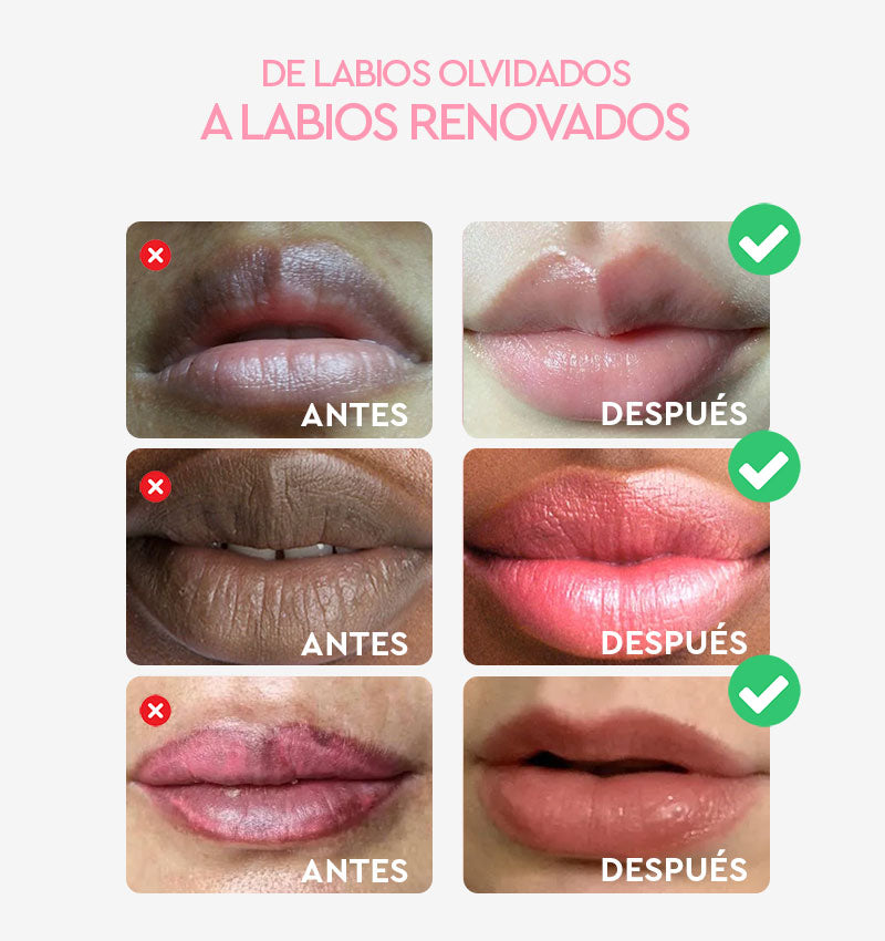 Rosa Renovación Labial